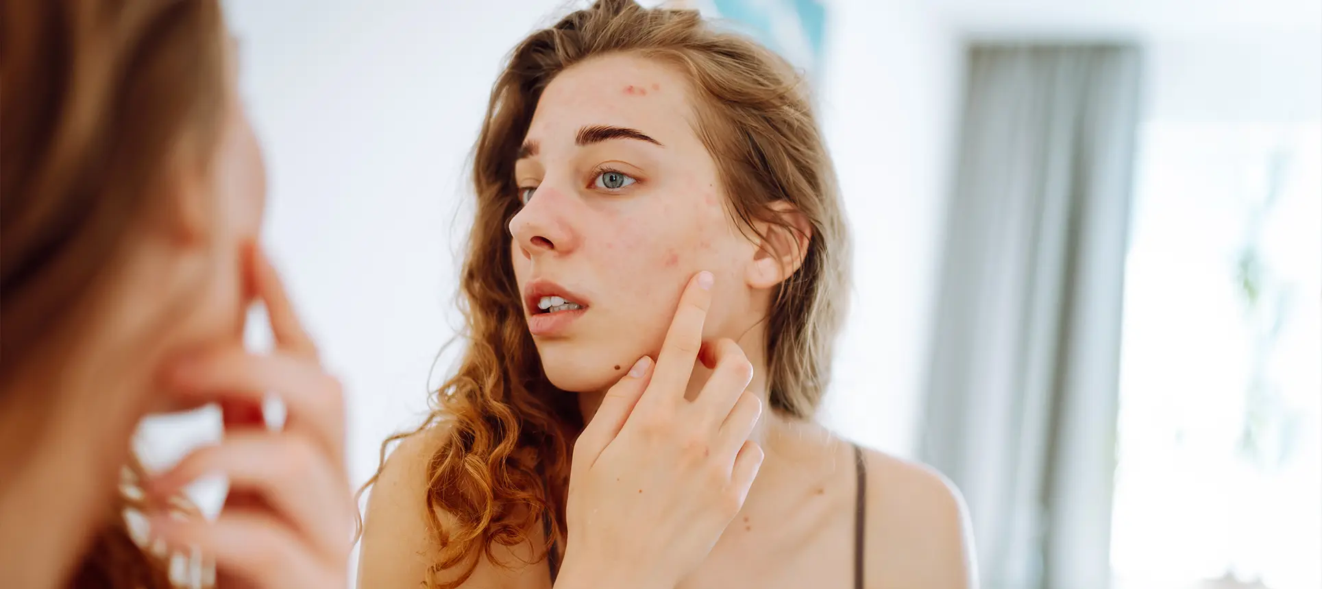 Tretinoin 0.1% for Acne and Photoaging: How Dermatologists Use It Safely